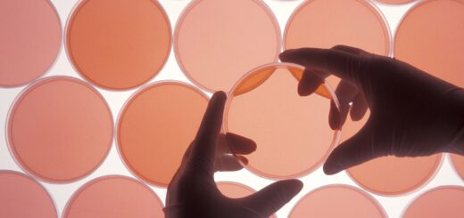 Deactivating A Cell Protein May Halt Progress Of Rheumatoid Arthritis